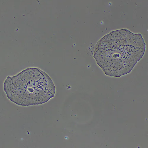 foto Dispositivo de contraste de fases MAGUS PH2,  15