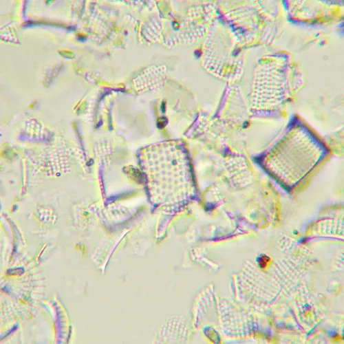fotografía Microscopio digital biológico MAGUS Bio D290T LCD,  32