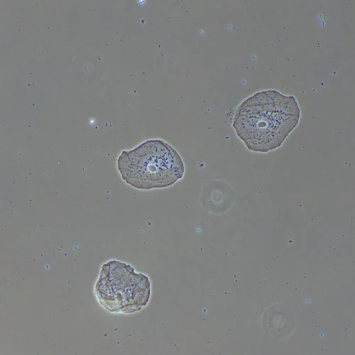 foto Dispositivo de contraste de fases MAGUS PH2,  14
