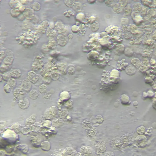 gráfico Dispositivo MAGUS HCM360 para trabajar con el contraste de modulación Hoffman, con juego de objetivos,  15