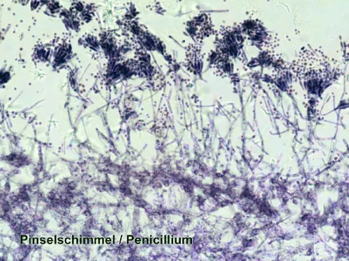 imagen Set de preparaciones Bresser, 100 unidades, con estuche,  7