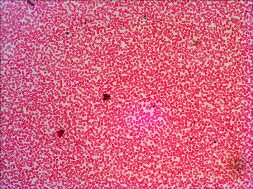 fotografía Set de preparaciones Levenhuk N38 NG,  16