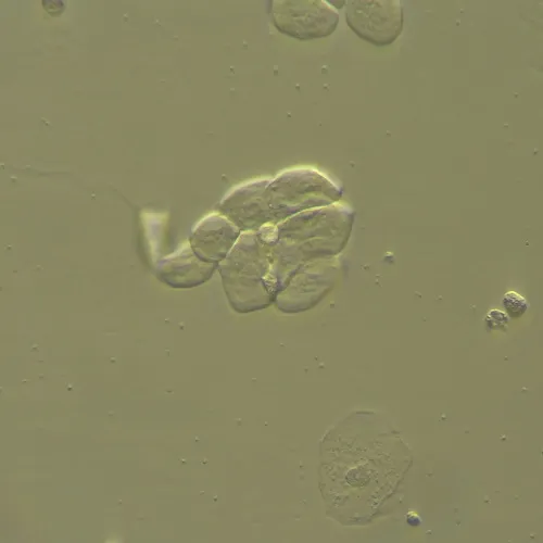 gráfico Dispositivo MAGUS HCM360 para trabajar con el contraste de modulación Hoffman, con juego de objetivos,  13